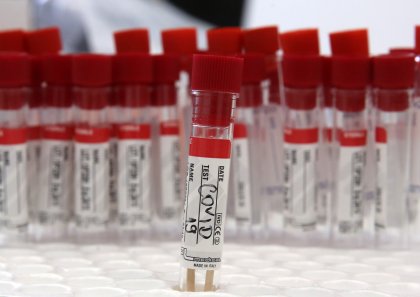 4,820 PCR Tests Confirm 240 COVID-19 Cases, Bringing Bulgaria's Total to 21,336 4,820 PCR Tests Confirm 240 COVID-19 Cases, Bringing Bulgaria's Total to 21,336