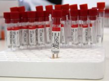 Заболеваемостта от COVID-19 в област Пловдив надхвърли на 14-дневна база 300 на 100 000 души население