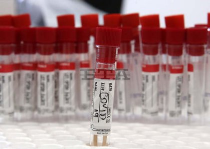 COVID-19 Update: 620 New Cases, Test Positivity Rate at 8% COVID-19 Update: 620 New Cases, Test Positivity Rate at 8%