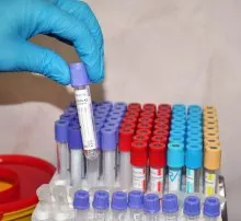 COVID-19 Update:  1,640 New Cases, Test Positivity Rate at 5.46%