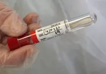 COVID-19 Update: 488 New Cases, Test Positivity Rate at 4.02%