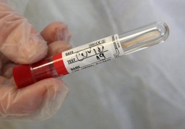Второ денонощие новите случаи на COVID - 19 в Пернишка област надхвърлят 100